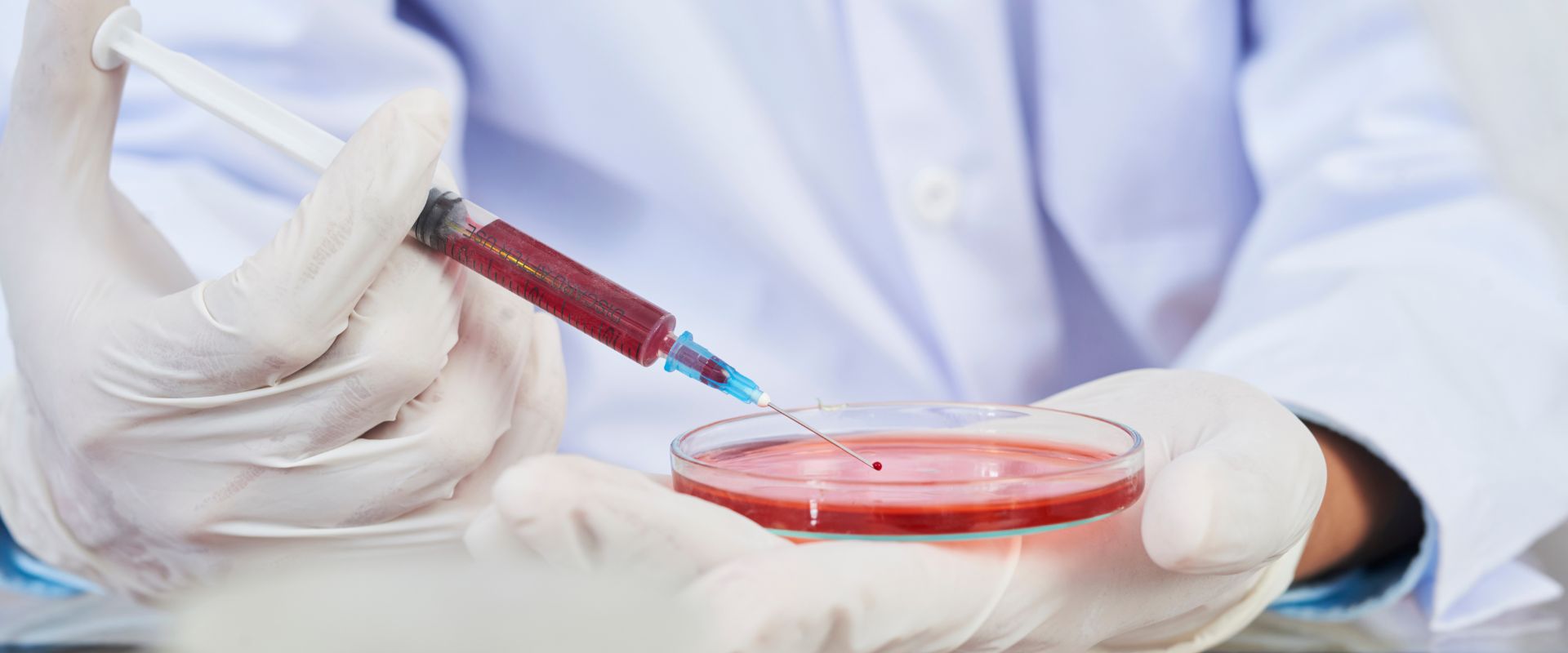 Krv iz pupčanika u borbi protiv dečije cerebralne paralize